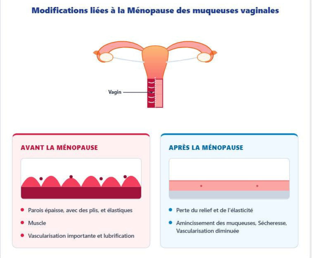 Modifications muqueuses vaginales liées à la ménopause