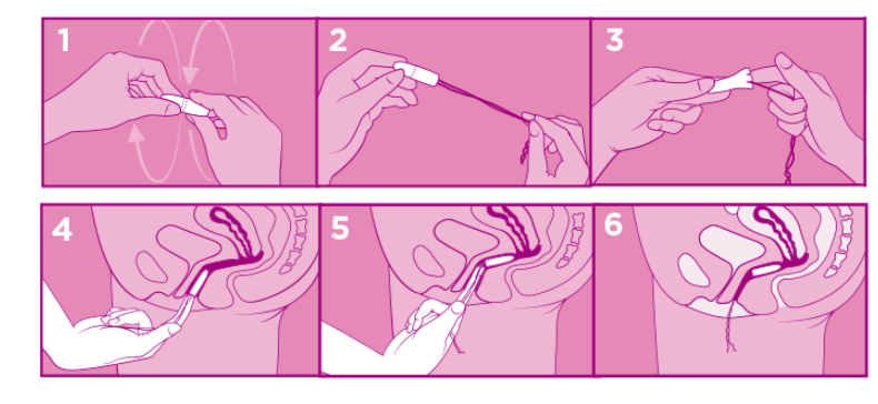 Étapes d’utilisation d’un tampon sans applicateur illustrées en 6 étapes